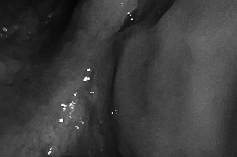 Quattro chili e mezzo